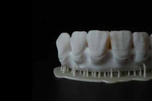 Resine per provvisori e definitivi: sono davvero tutte fragili?